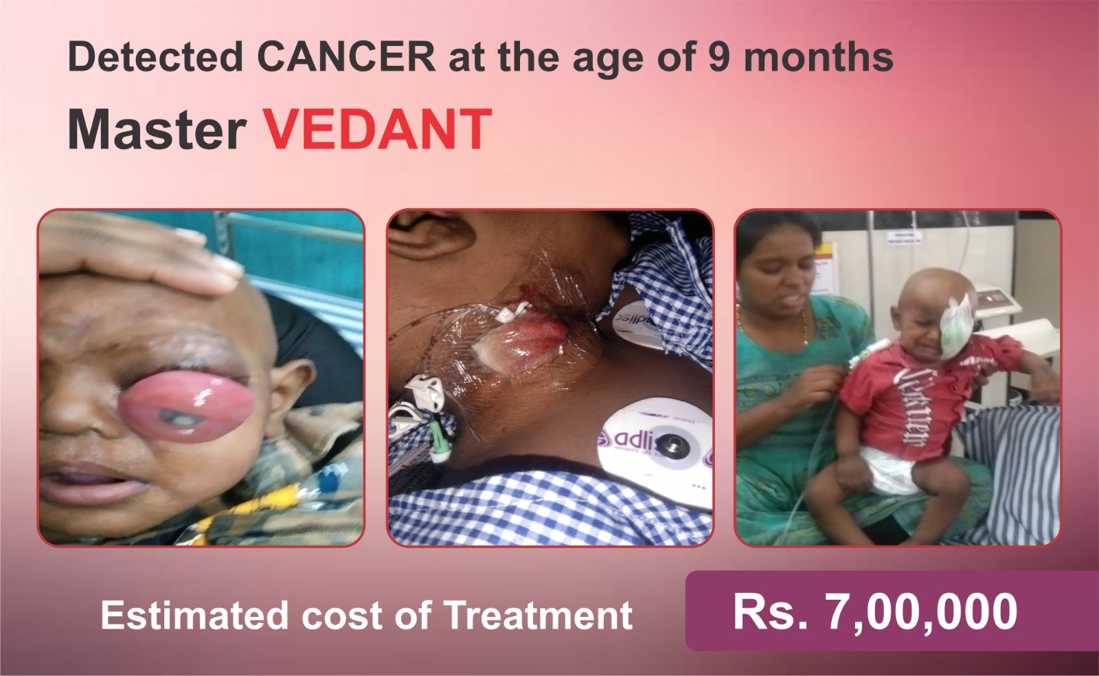 Urgent Help Needed to Save 13 month Old Vedant (CASE CLOSED)
